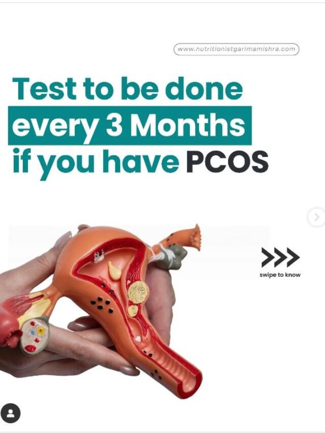 Essential PCOS Tests for Every 3 Months